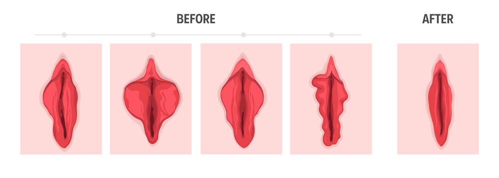 A tight Vagina
