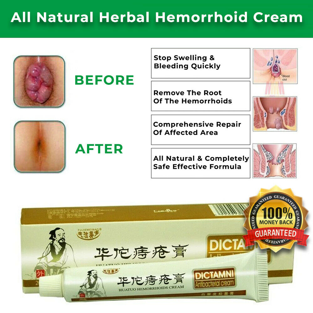 Anal Fissure Cream (4)