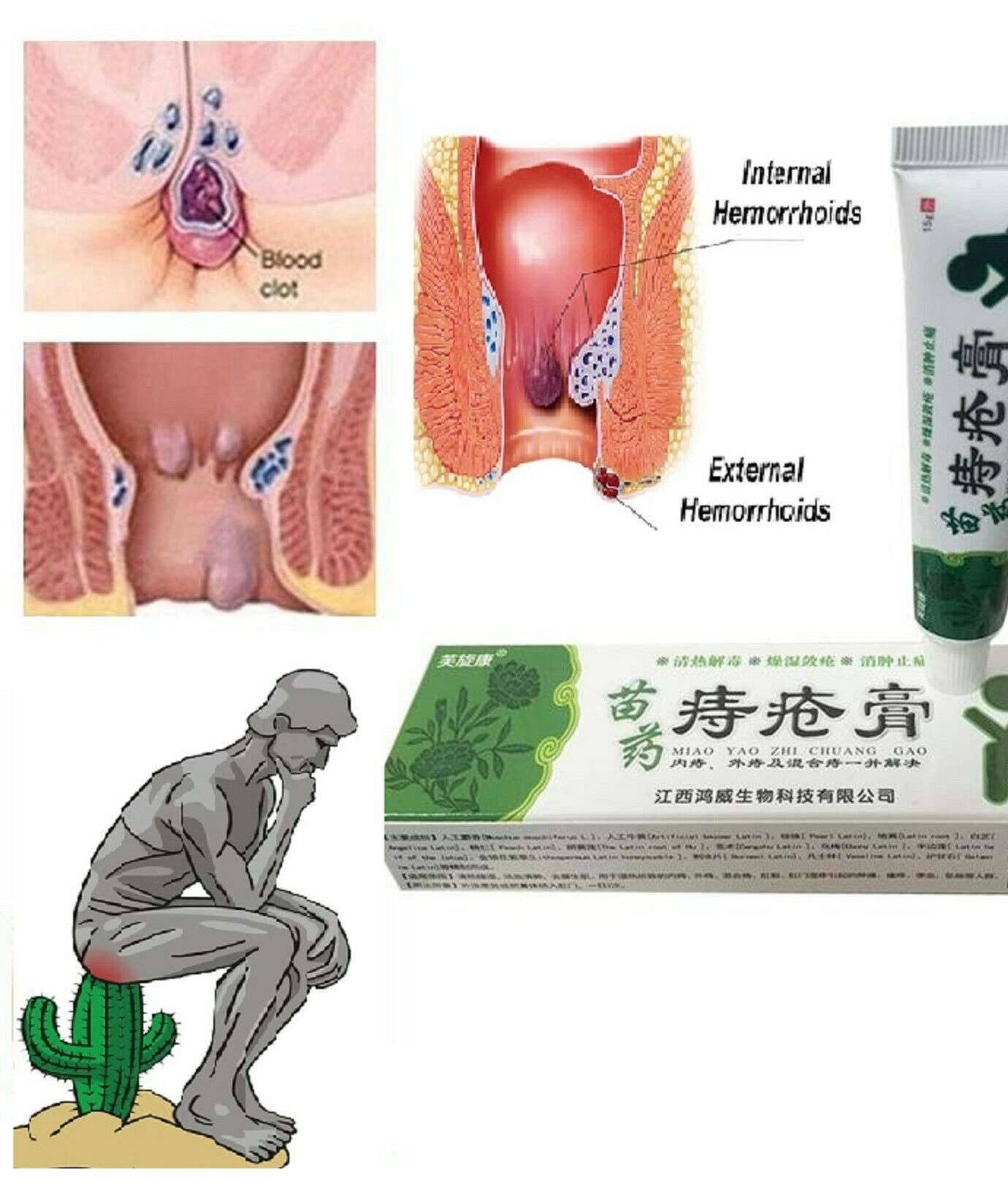 Anal Fissure Treatment (6)