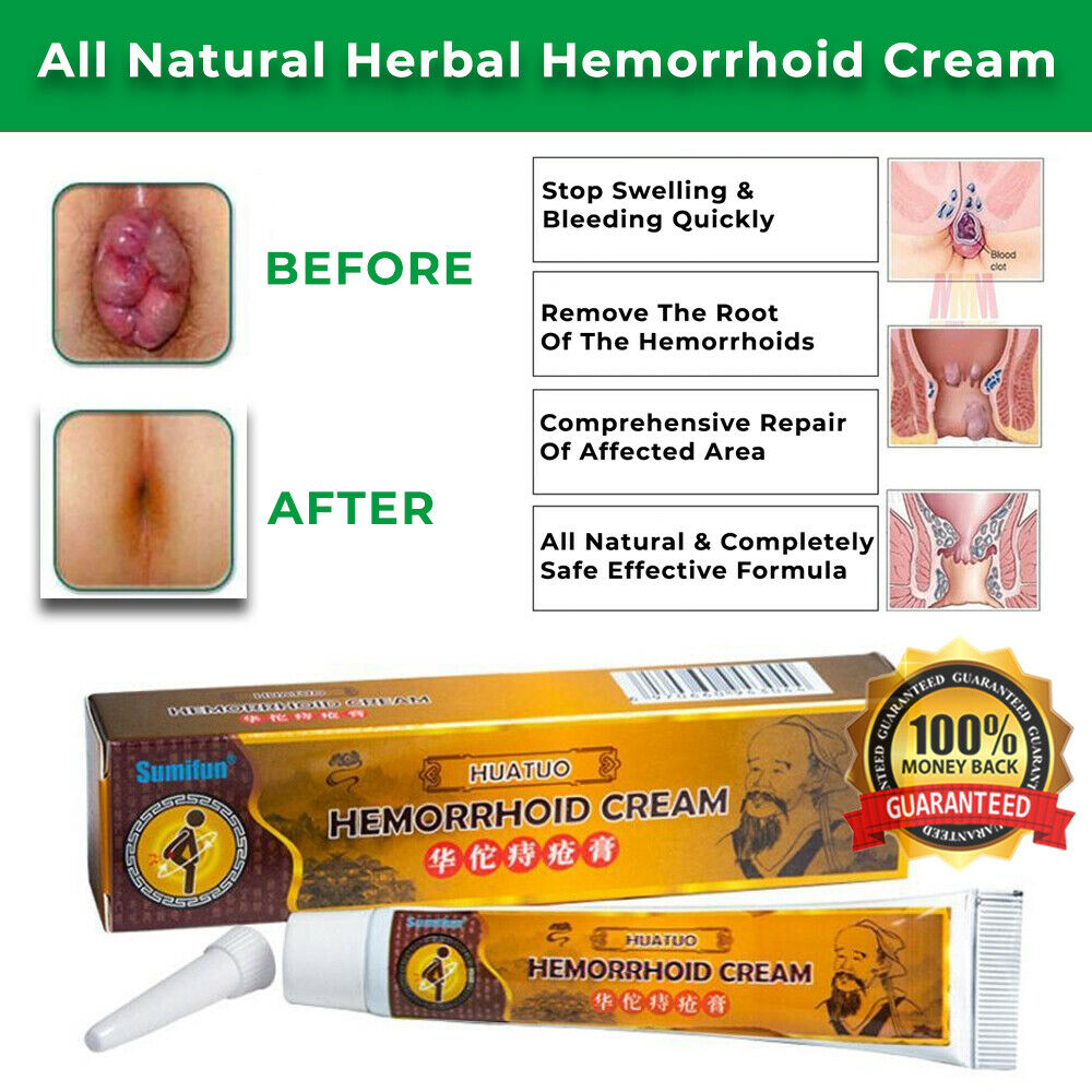 Hemorrhoid Anus Cream (1)