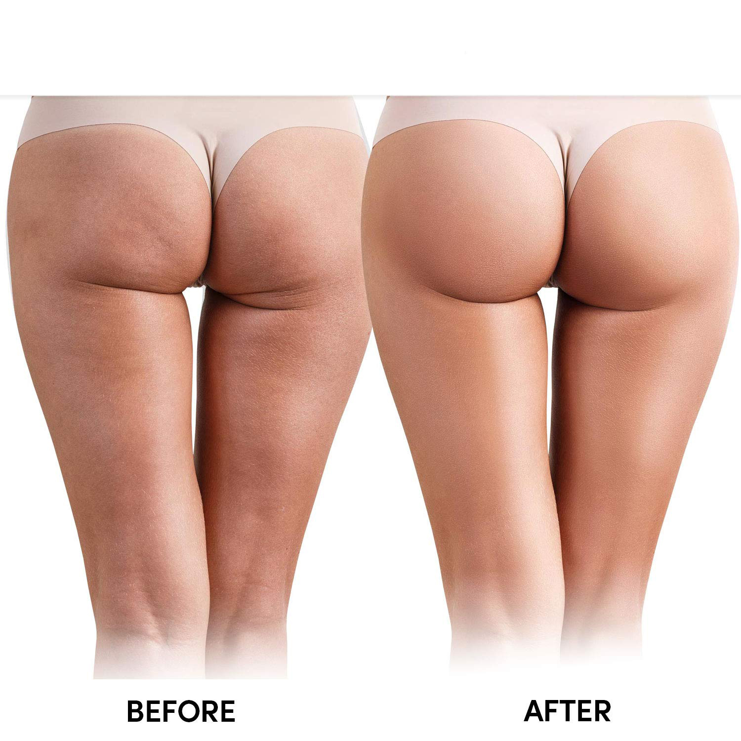 Hips Enhancement Cream (2)